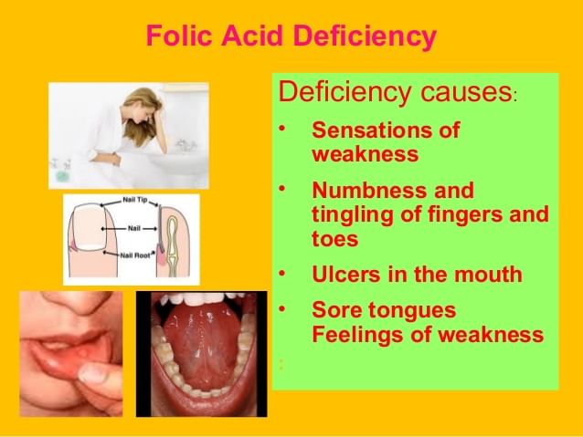 Vitamin B9 (Folic Acid) - Deficiency Risk And Symptoms - By Dr ...