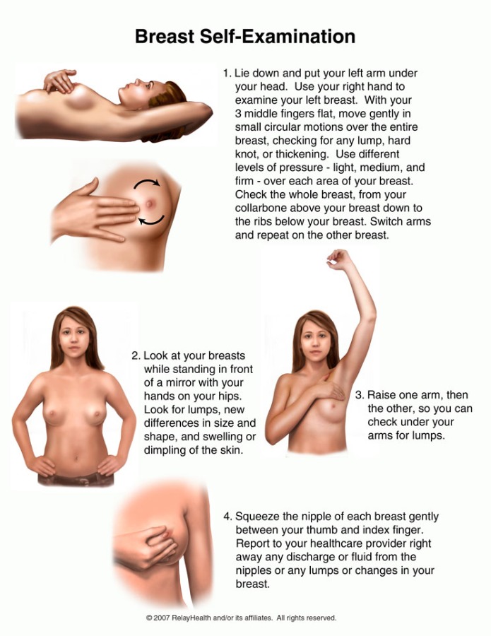 Cancer pictures breast lumps of Cancer pictures breast lumps of