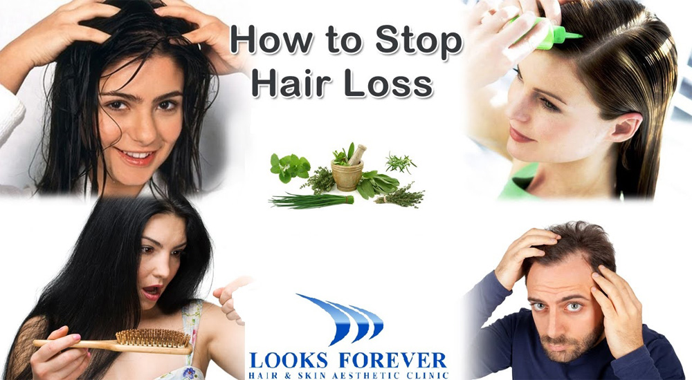 Hair Loss Treatment Tips Advice From Top Doctors Lybrate Page 9