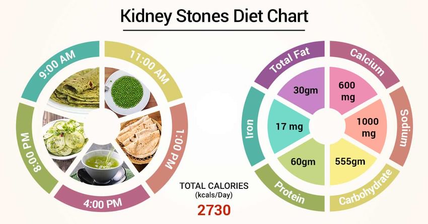 Kidney Stone Chart