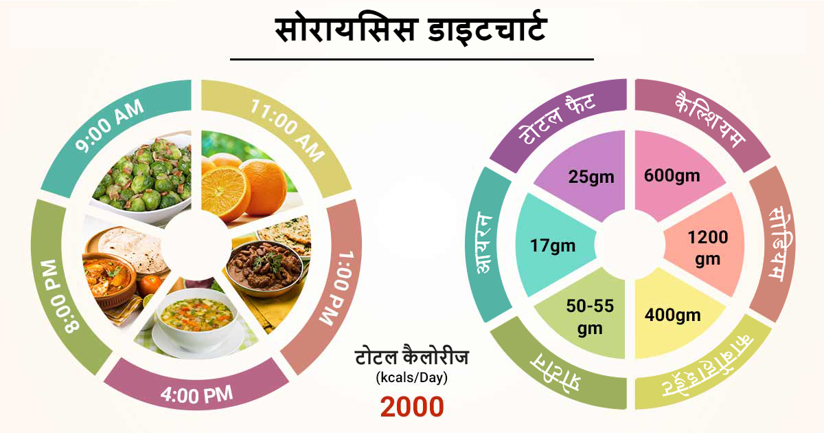 इसके बारे में