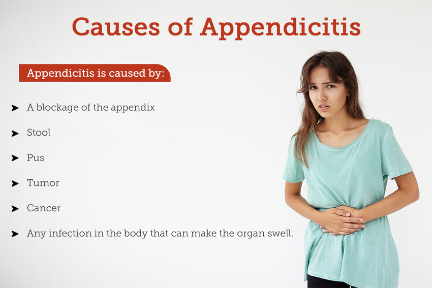 Appendicitis Symptoms Causes Treatment And Diagnosis