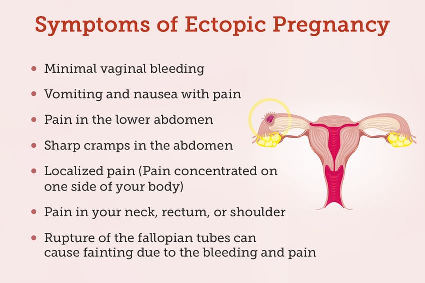 Ectopic Pregnancy Causes Symptoms Treatments And More 2773