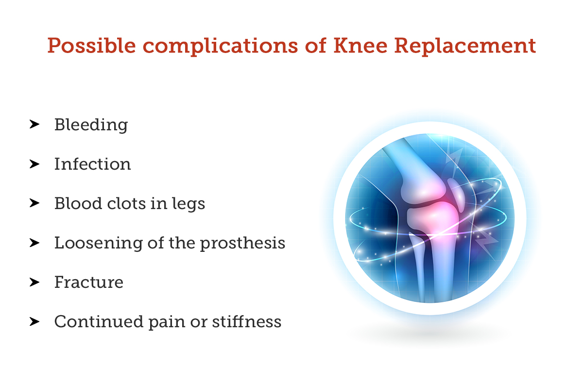 Knee Replacement Procedure, Recovery, Cost, Risk & Complication