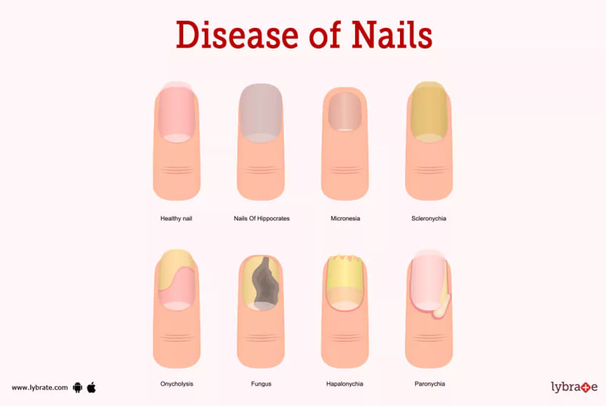 Burnaby Nail Places