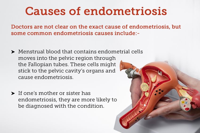 Endometriosis and Infertility Treatment Management, Complication