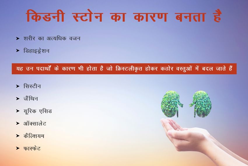 kidney-stones-in-hindi