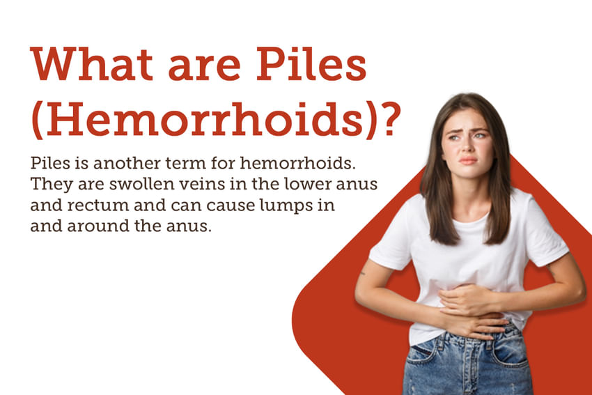 Piles: Symptoms, Causes, Treatment and Cost