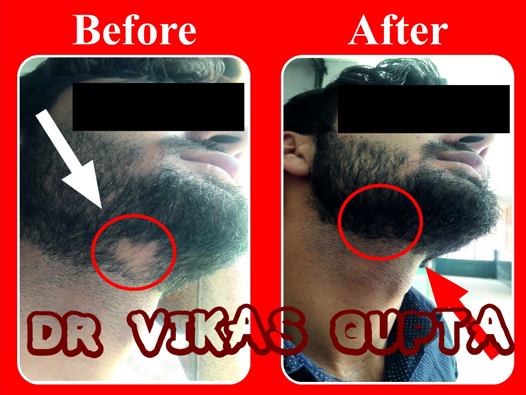 Dr. Vikas Gupta - Ayur Health Care Image 44