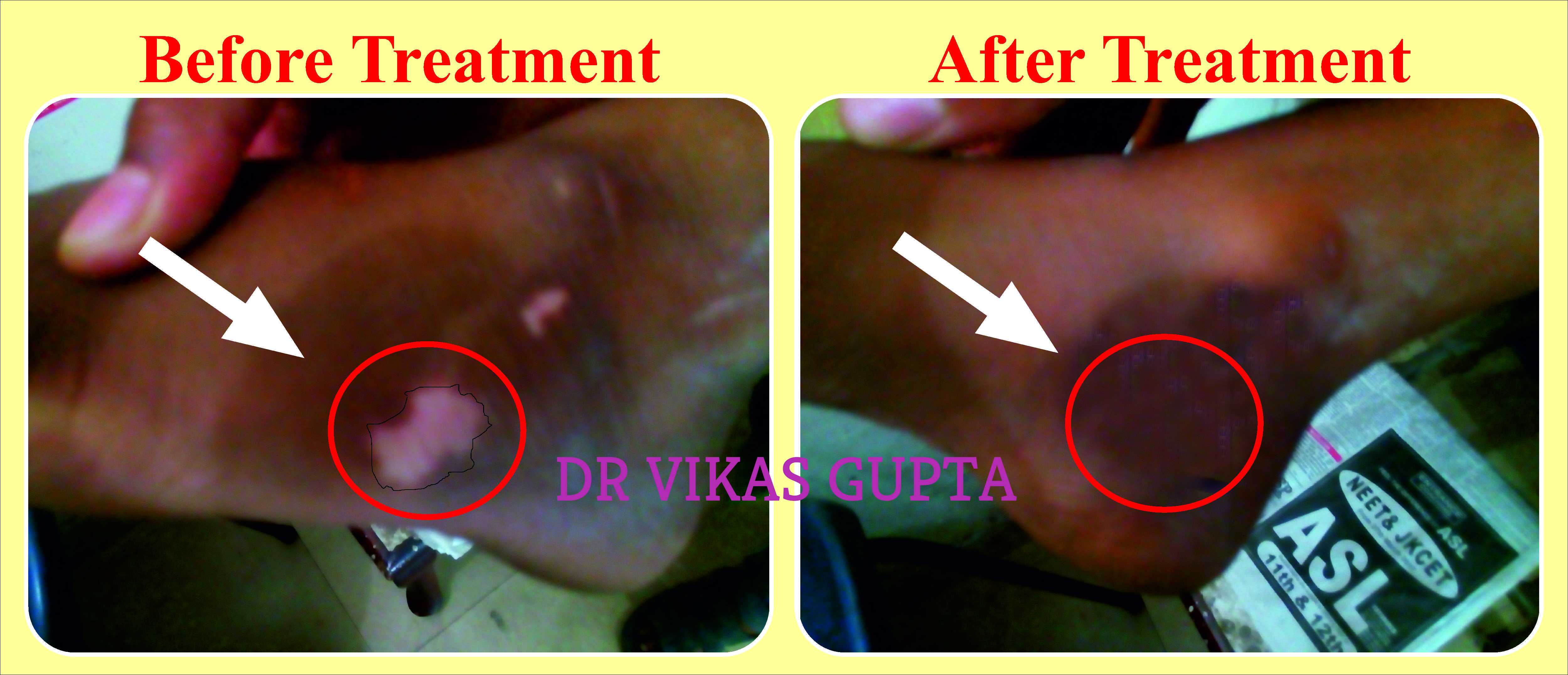 Dr. Vikas Gupta - Ayur Health Care Image 46