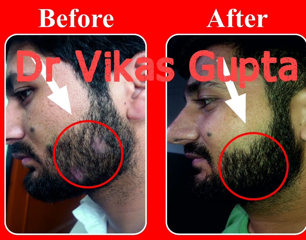 Dr. Vikas Gupta - Ayur Health Care Image 45