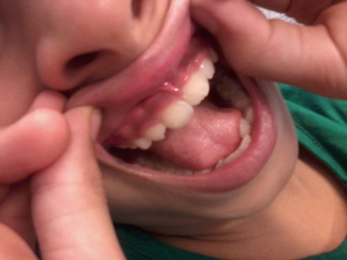 Dr.Havewala's Dental Clinic Image 9