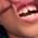 Dr.Havewala's Dental Clinic Image 6