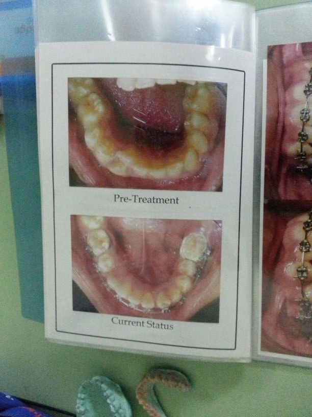 Dr.Ankit Khurana's CITY DENTAL CLINIC & IMPLANT CENTRE,(A Multispeciality Dental Clinic In Vidisha) Image 9
