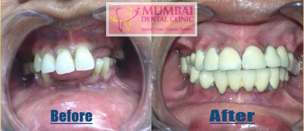 Mumbai Dental Clinic & Implant Centre Image 6