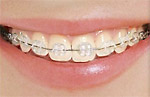 Dr Prachi Patils Professional Dental Care Image 1
