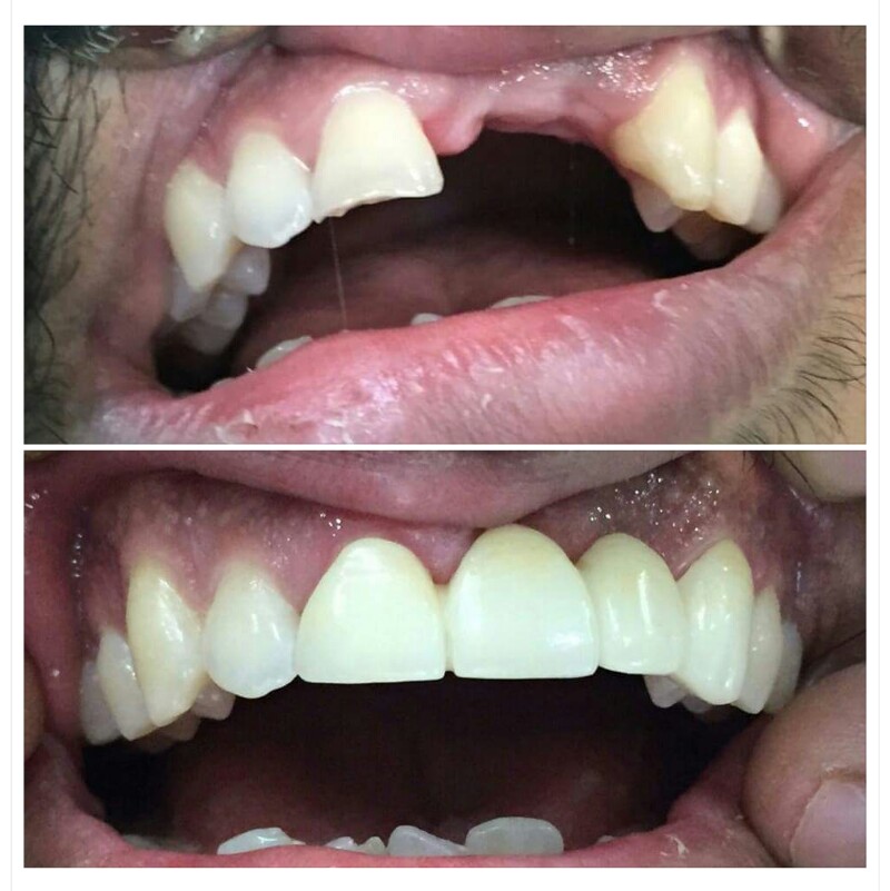 De Cure - A Multispeciality Clinic For Dental & Physiotherapy Image 11