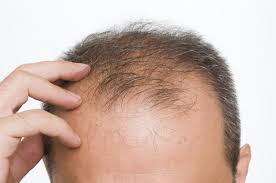 Ishira Skin Clinic - Ashok Vihar phase 3 Image 2