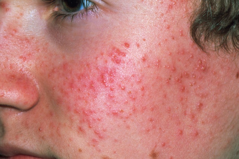 Ishira Skin Clinic - Ashok Vihar phase 3 Image 1