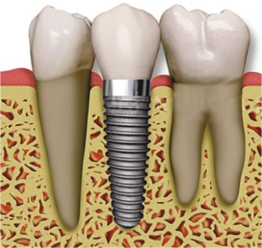 The Dentists Image 1