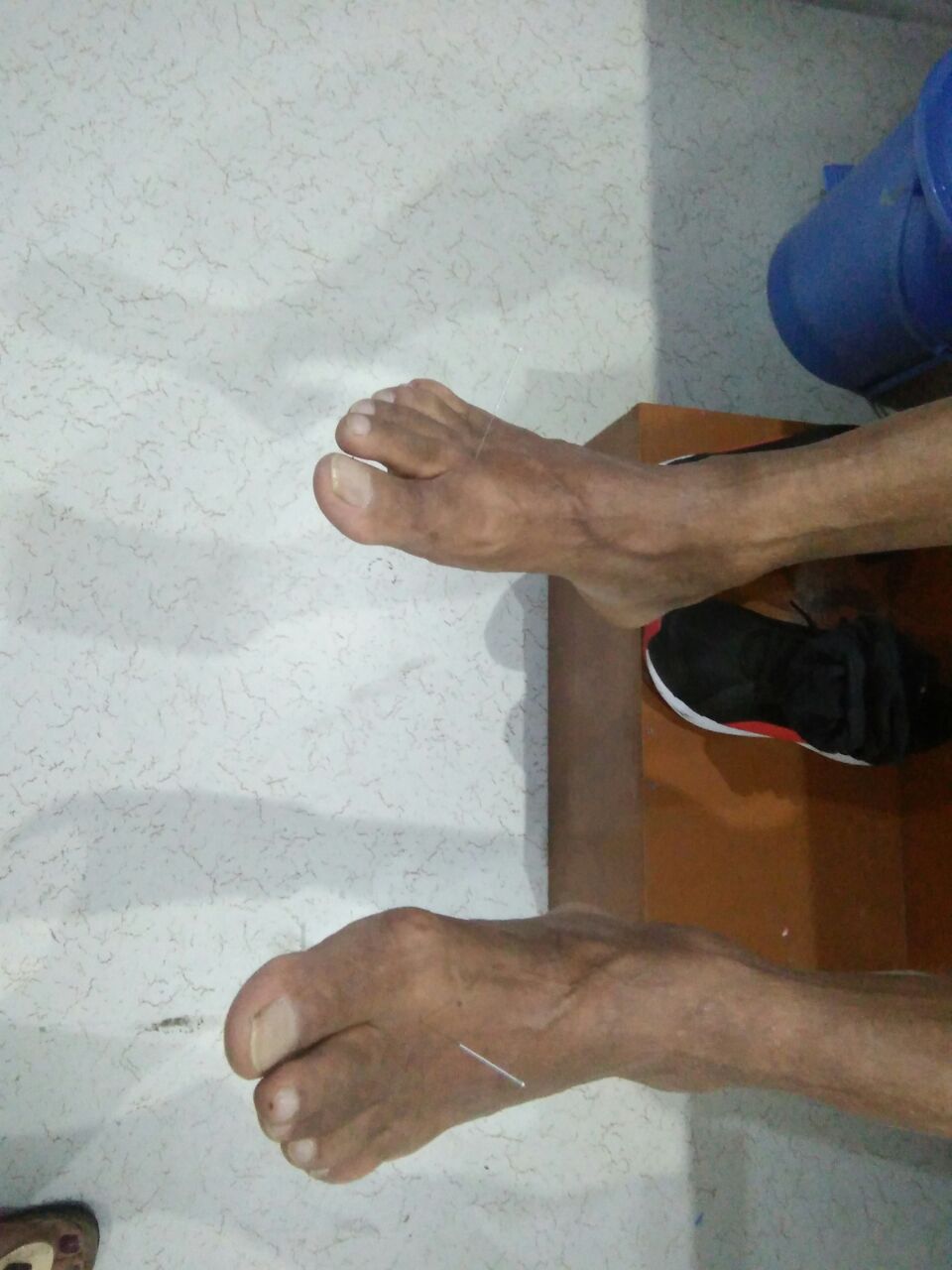 Rid of Pain Physiotherapy Sector 43 Gurgaon Image 2