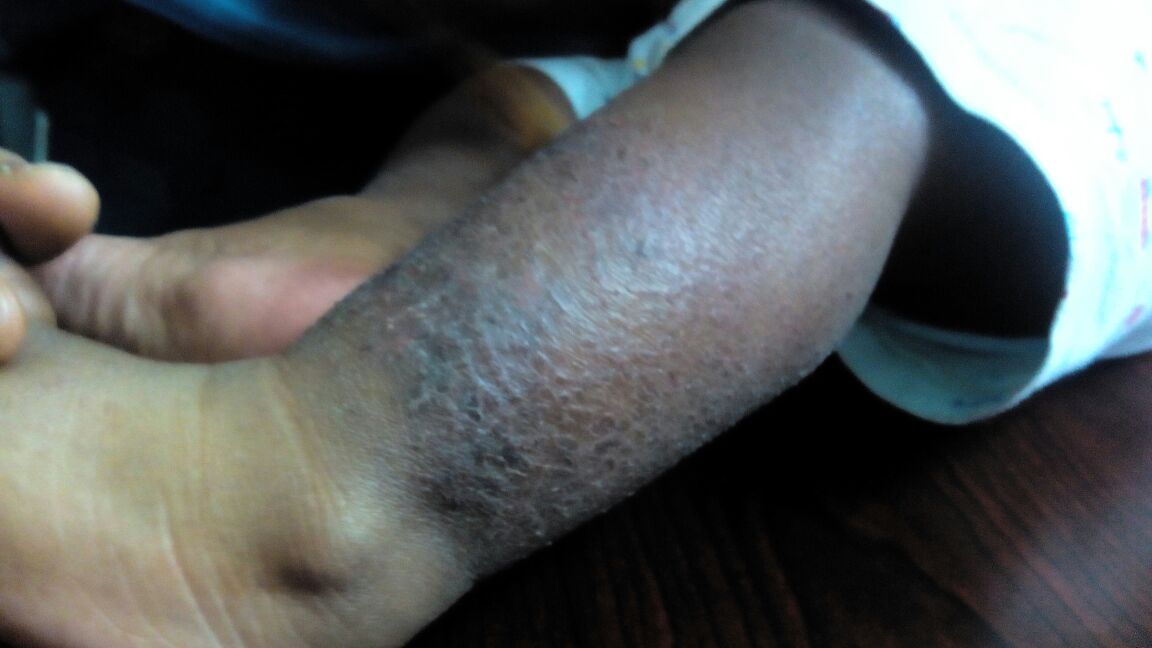 Aswini Allergy Centre Image 25