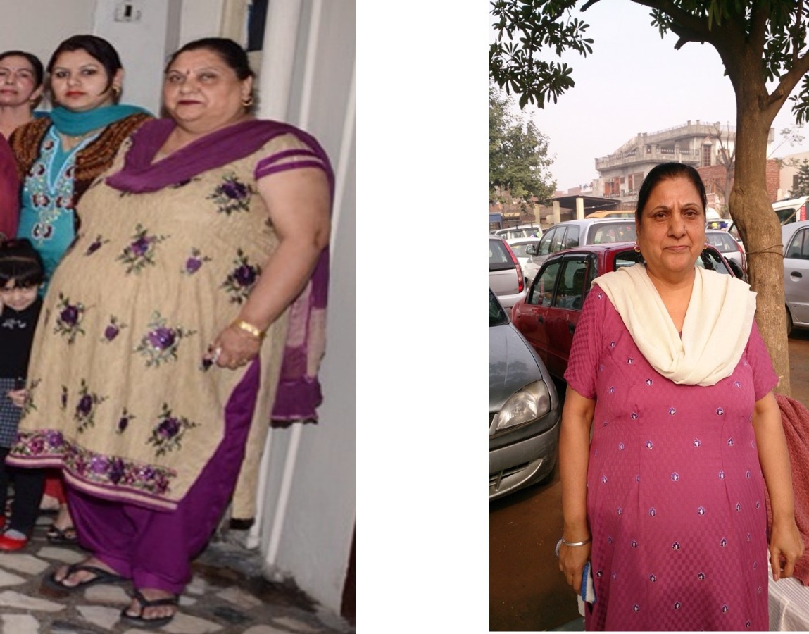 CODMAS - Centre for Obesity, Diabetes & Minimal Access Surgery Image 1