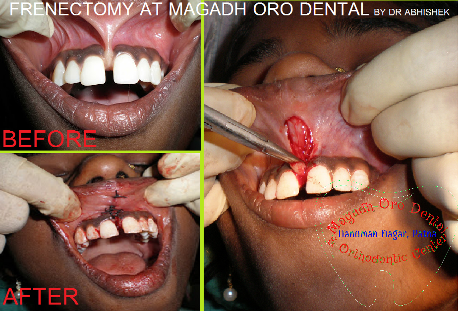 Magadh Oro Dental & Orthodontic Center , Chandi (Nalanda) Image 1