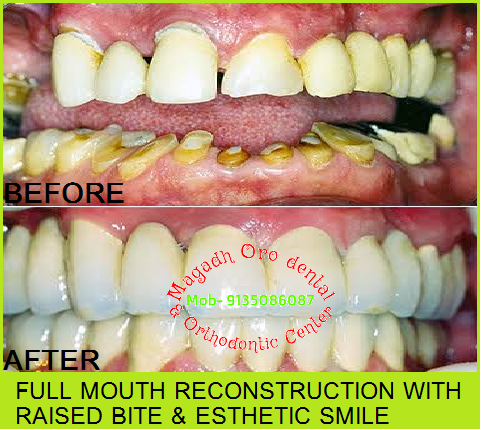 Magadh Oro Dental & Orthodontic Center , Chandi (Nalanda) Image 5