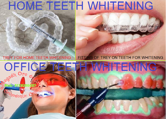 Magadh Oro Dental & Orthodontic Center , Chandi (Nalanda) Image 6