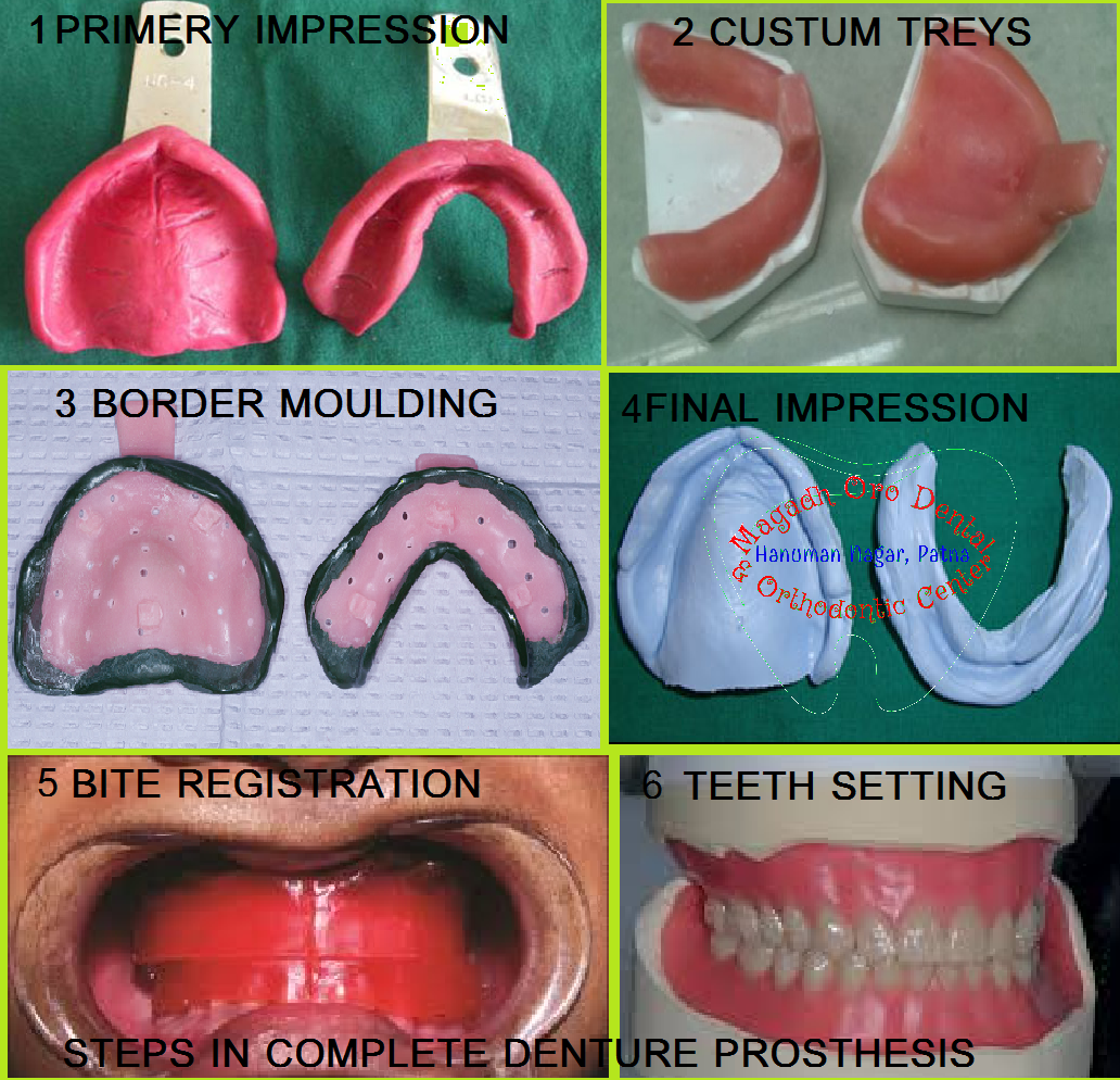 Magadh Oro Dental & Orthodontic Center , Chandi (Nalanda) Image 2