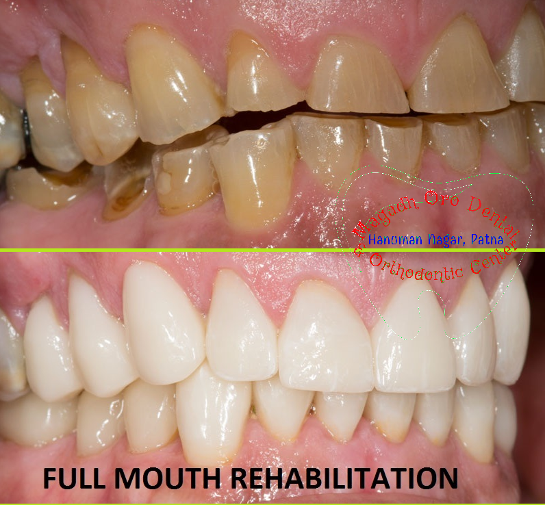 Magadh Oro Dental & Orthodontic Center , Chandi (Nalanda) Image 3