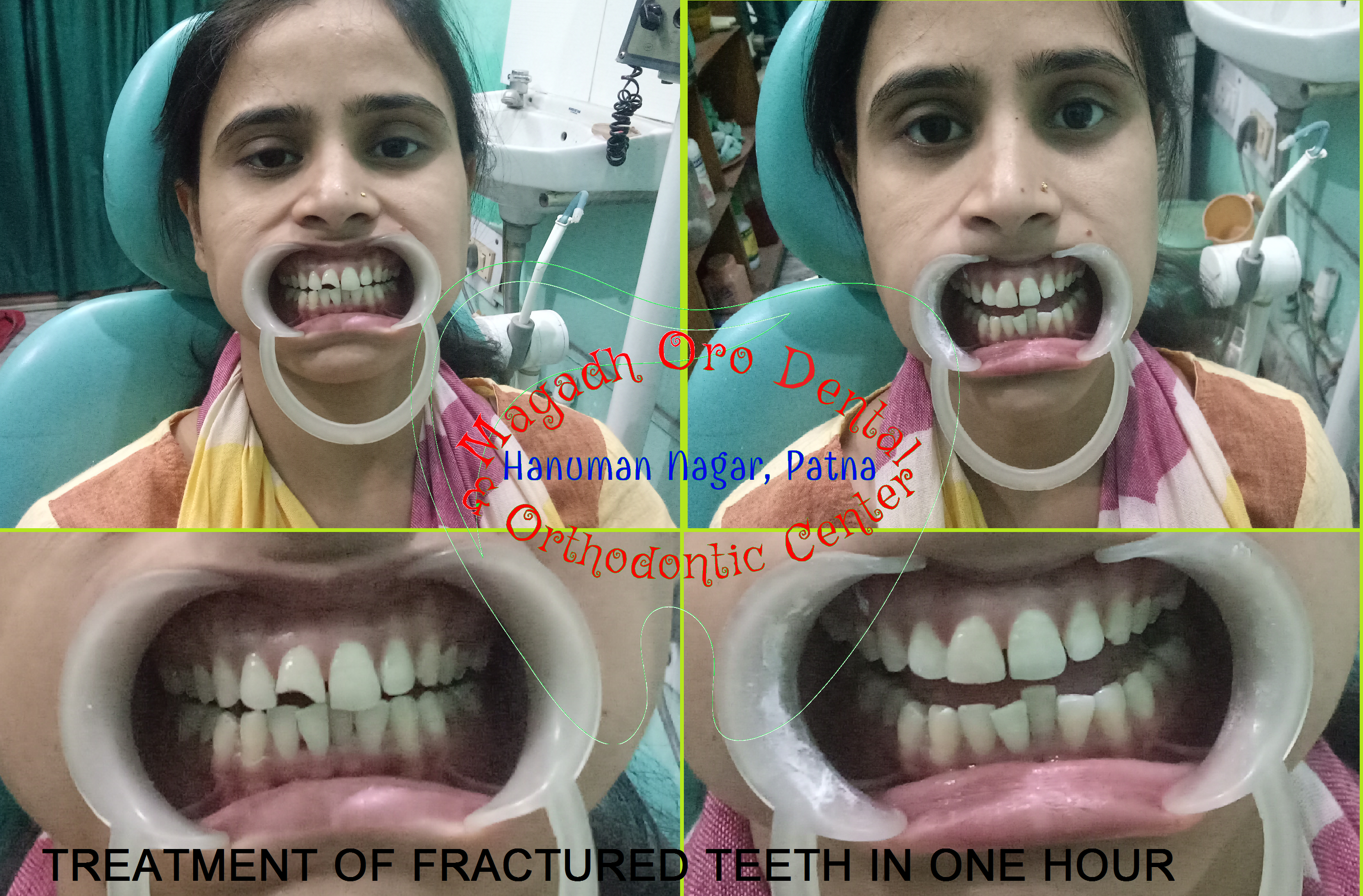 Magadh Oro Dental & Orthodontic Center , Chandi (Nalanda) Image 4