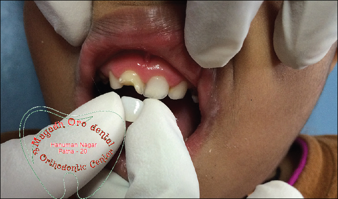 Magadh Oro Dental & Orthodontic Center Image 8