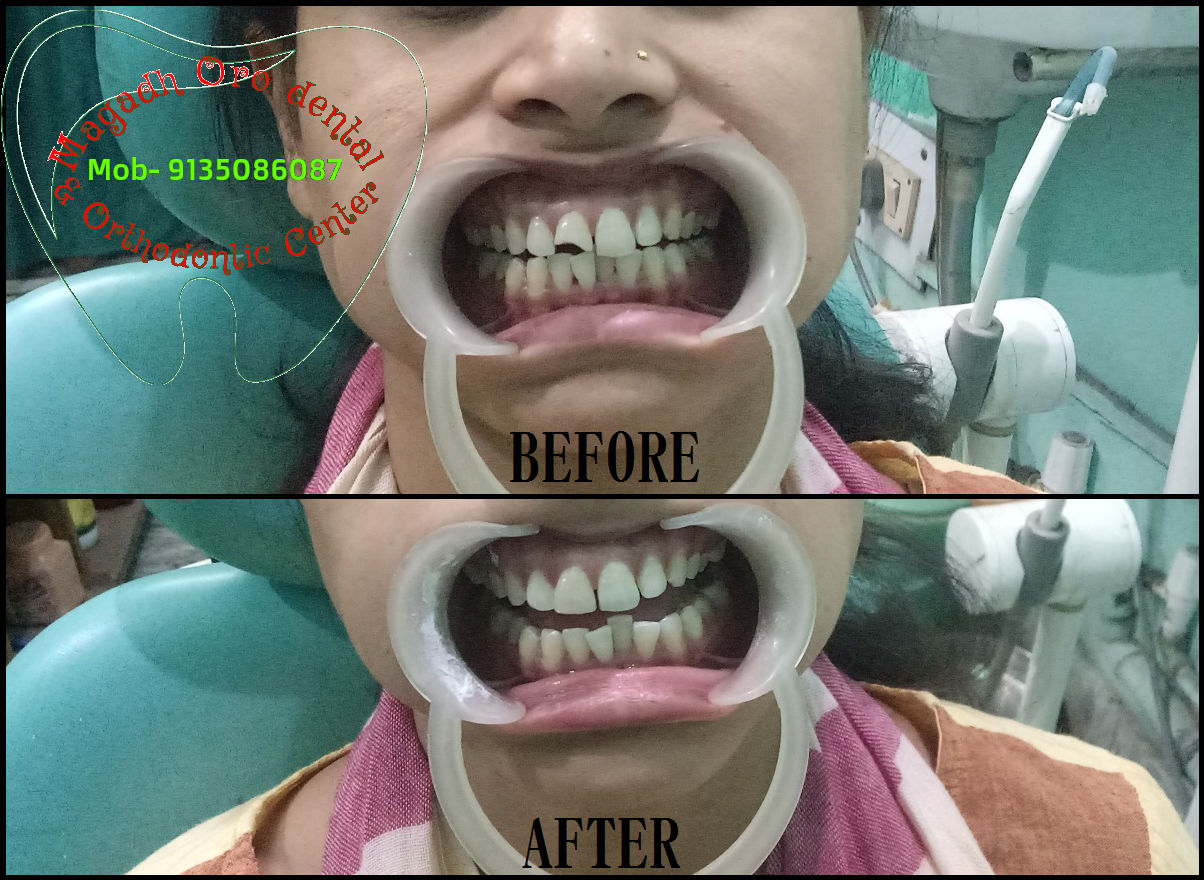 Magadh Oro Dental & Orthodontic Center Image 3