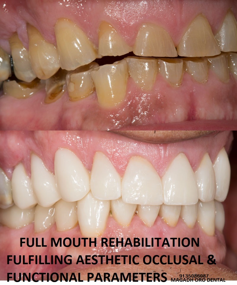 Magadh Oro Dental & Orthodontic Center Image 10