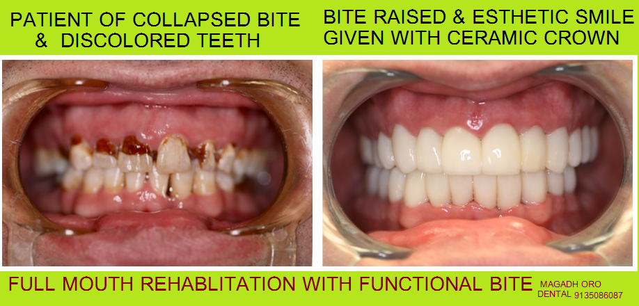 Magadh Oro Dental & Orthodontic Center Image 12