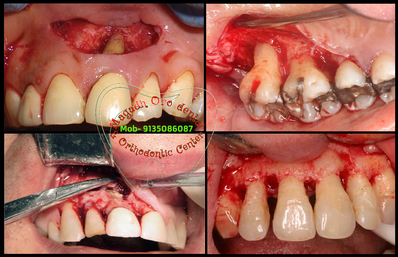 Magadh Oro Dental & Orthodontic Center Image 5