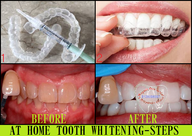Magadh Oro Dental & Orthodontic Center Image 11