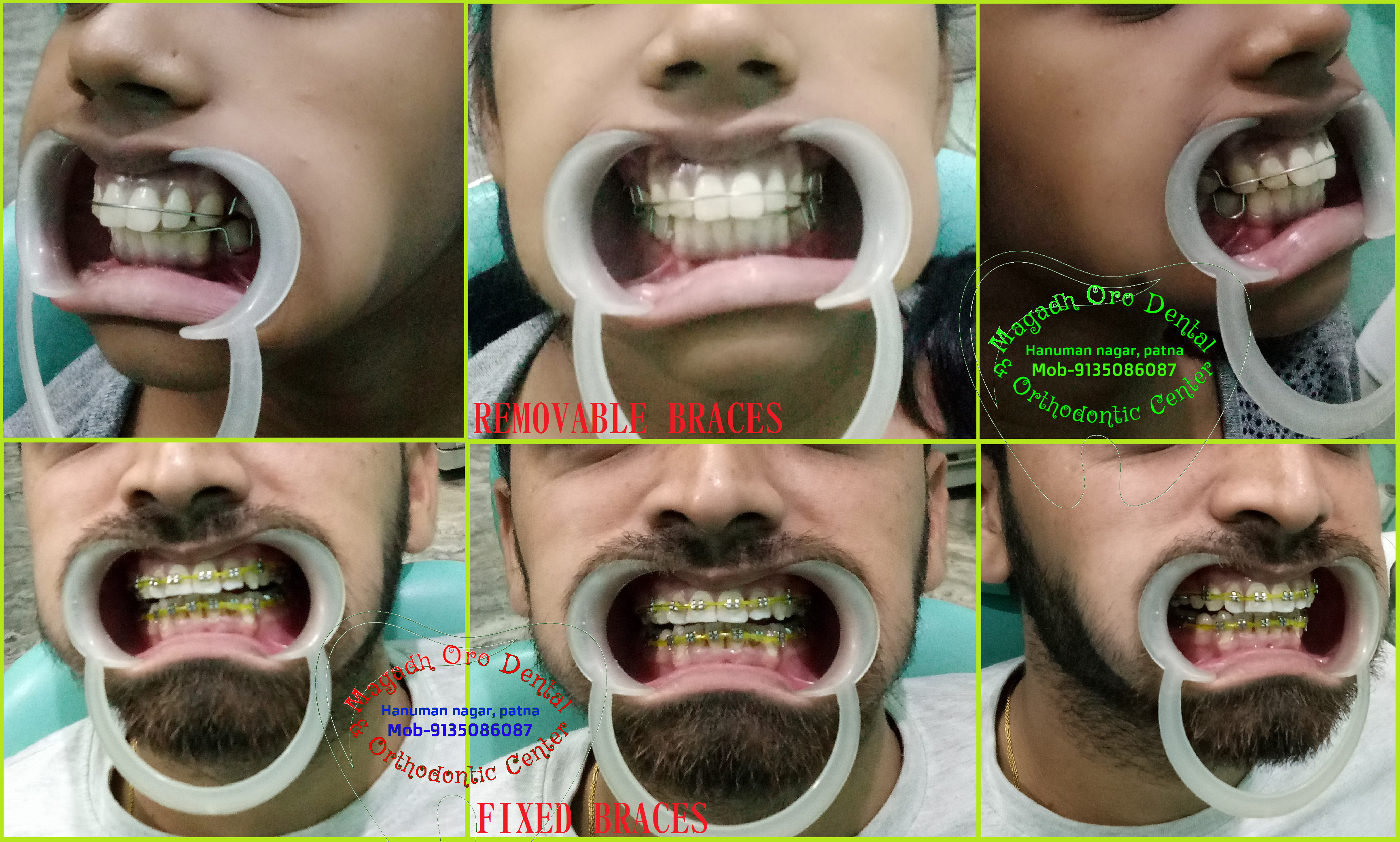 Magadh Oro Dental & Orthodontic Center Image 2