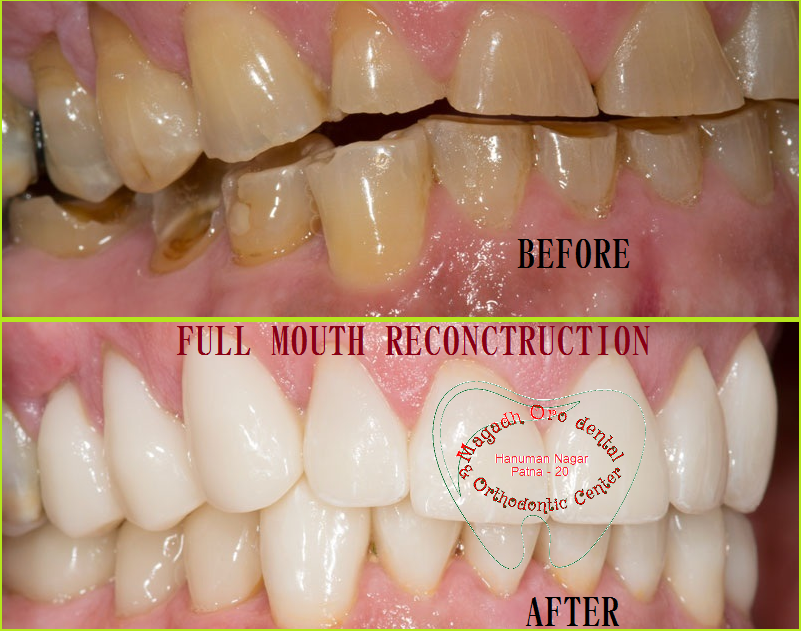 Magadh Oro Dental & Orthodontic Center Image 7