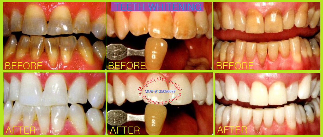 Magadh Oro Dental & Orthodontic Center Image 1
