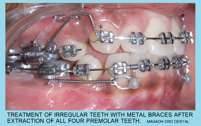 Magadh Oro Dental & Orthodontic Center Image 8