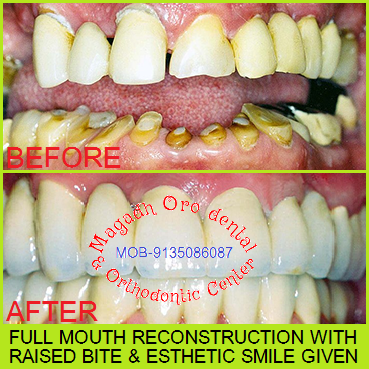 Magadh Oro Dental & Orthodontic Center Image 6