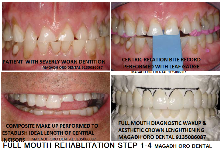 Magadh Oro Dental & Orthodontic Center Image 15