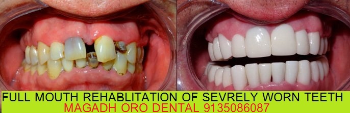 Magadh Oro Dental & Orthodontic Center Image 13