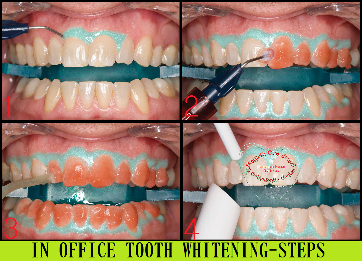 Magadh Oro Dental & Orthodontic Center Image 12