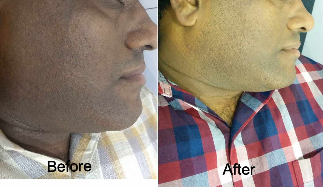 Peachtree Beauty, Hair & Slimming Clinic Image 6