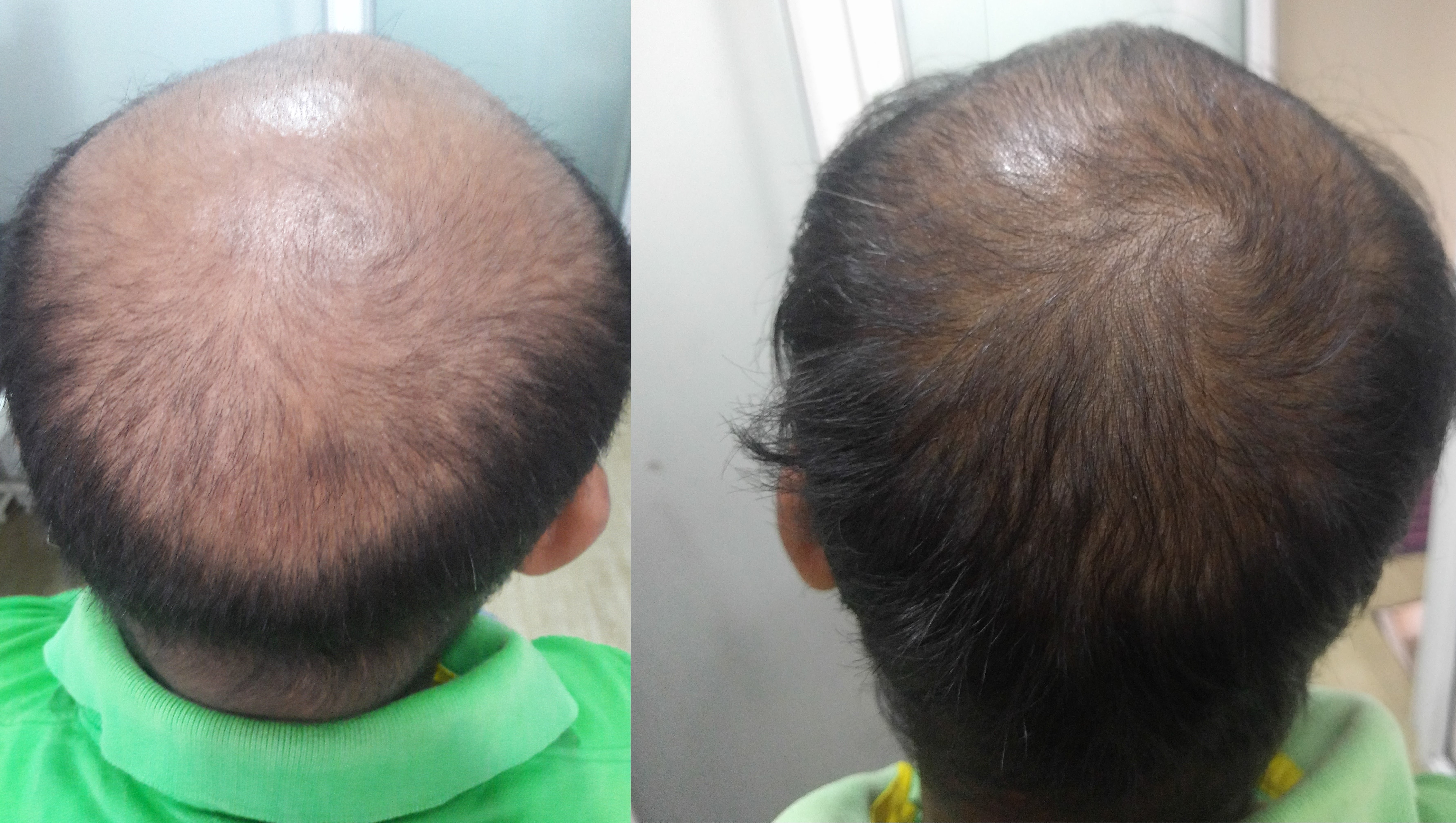 Peachtree Beauty, Hair & Slimming Clinic Image 8