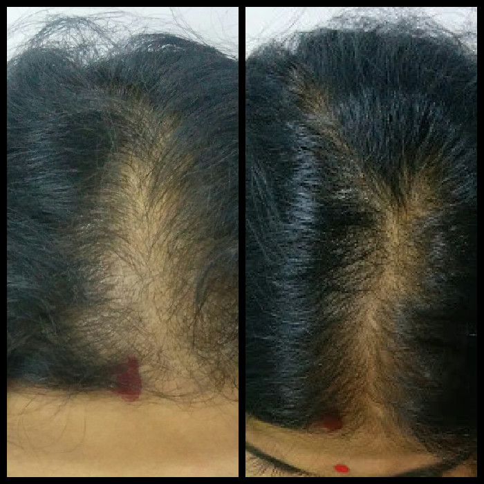Peachtree Beauty, Hair & Slimming Clinic Image 4